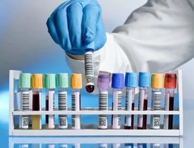 Αλτσχάιμερ: Μια απλή εξέταση αίματος μπορεί να προβλέψει τη νόσο 16 χρόνια νωρίτερα (βίντεο)